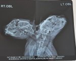 Shen X-ray Head.jpg